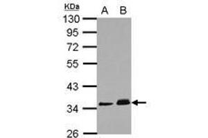 Image no. 1 for anti-Protein Phosphatase 1J (PPM1J) (AA 133-442) antibody (ABIN1500379) (PPM1J Antikörper  (AA 133-442))