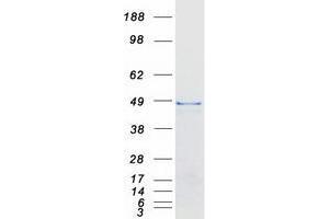 Western Blotting (WB) image for Ubiquitin Specific Peptidase 2 (USP2) (Transcript Variant 2) protein (Myc-DYKDDDDK Tag) (ABIN2735099)