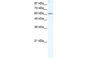 WB Suggested Anti-METTL3 Antibody Titration:  5. (METTL3 Antikörper  (Middle Region))