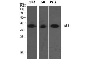 Western Blot (WB) analysis of HeLa KB PC-3 using p38 Polyclonal Antibody. (MAPK14 Antikörper)