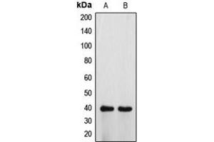 Western blot analysis of ATP6V0D1 expression in HeLa (A), H9C2 (B) whole cell lysates. (ATP6V0D1 Antikörper  (Center))