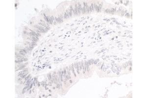 anti-Protein-L-Isoaspartate (D-Aspartate) O-Methyltransferase (PCMT1) (AA 803-853) antibody