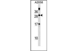 Western blot analysis of PLA2G12A Antibody (Center) in A2058 cell line lysates (35ug/lane). (PLA2G12A Antikörper  (Middle Region))