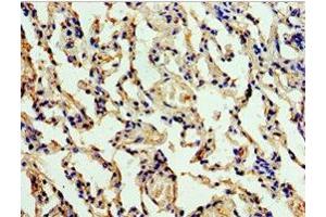 Immunohistochemistry of paraffin-embedded human lung tissue using ABIN7147563 at dilution of 1:100 (ALG1 Antikörper  (AA 215-464))