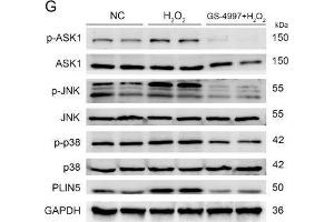 The expression of PLIN5 was regulated by the JNK-p38-ATF pathway. (MAPK14 Antikörper  (pThr180, pTyr182))