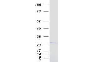 Western Blotting (WB) image for Inhibitor of Growth Family, Member 4 (ING4) (Transcript Variant 1) protein (Myc-DYKDDDDK Tag) (ABIN2723449)