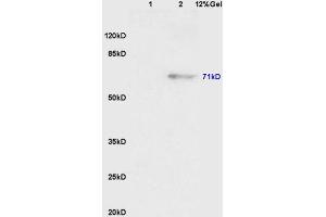 Lane 1: mouse embryo lysates Lane 2: mouse pancreas lysates probed with Anti Phospho-Wee1(Ser123) Polyclonal Antibody, Unconjugated (ABIN756592) at 1:200 in 4 °C.