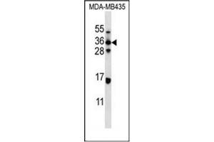 Western blot analysis of ELOVL5 Antibody (C-term) in MDA-MB435 cell line lysates (35ug/lane). (ELOVL5 Antikörper  (C-Term))