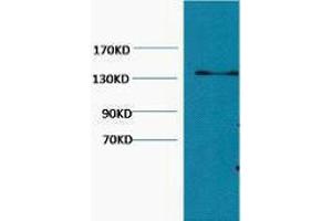 Western Blotting (WB) image for anti-Collagen, Type III (COL3) antibody (ABIN3178676) (COL3 Antikörper)