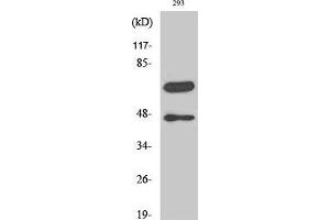 Western Blot analysis of 293 cells with Cleaved-CASP8 (D384) Polyclonal Antibody
