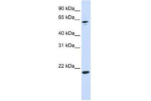 APRT antibody used at 1 ug/ml to detect target protein. (APRT Antikörper  (N-Term))