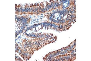 Immunohistochemistry (IHC) image for anti-LI Cadherin antibody (ABIN7268249)