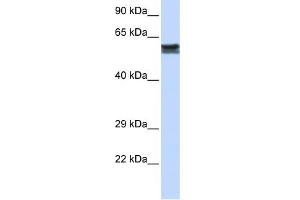 WB Suggested Anti-FYN Antibody Titration: 0. (FYN Antikörper  (N-Term))