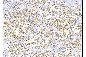 IHC analysis of RALBP1 using anti-RALBP1 antibody (ABIN7600800). (RALBP1 Antikörper  (AA 239-506))
