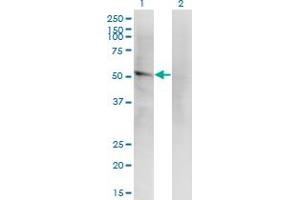 Western Blot analysis of LILRA2 expression in transfected 293T cell line by LILRA2 monoclonal antibody (M14), clone 4D7.