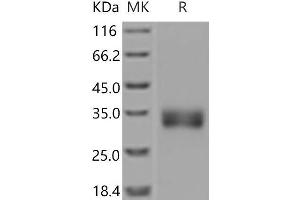 Western Blotting (WB) image for Sclerostin (SOST) protein (His tag) (ABIN7197841)