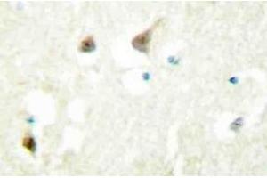 Immunohistochemistry (IHC) analyzes of hnRNP C1/C2 antibody in paraffin-embedded human brain tissue. (HNRNPC Antikörper)