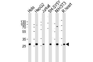Western blot analysis of lysates from Hela, HepG2, Jurkat, SH-SY5Y, mouse NIH/3T3 cell line and rat heart tissue lysate(from left to right), using VB Antibody (Center) 20627c. (VAPB Antikörper  (AA 126-139))
