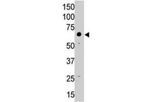 The MMP14 polyclonal antibody  is used in Western blot to detect MMP14 in A-375 cell lysate. (MMP14 Antikörper  (N-Term))