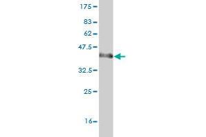 Western Blot detection against Immunogen (37. (arfgap2 Antikörper  (AA 331-431))