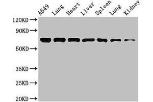 Western Blot Positive WB detected in: A549 whole cell lysate, Rat lung tissue, Mouse heart tissue, Mouse liver tissue, Mouse spleen tissue, Mouse lung tissue, Mouse kidney tissue All lanes: RPA1 antibody at 3. (RPA1 Antikörper  (AA 2-616))