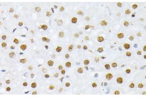 Immunohistochemistry of paraffin-embedded Rat liver using Phospho-Histone H2A(S129) Polyclonal Antibody at dilution of 1:100 (40x lens).