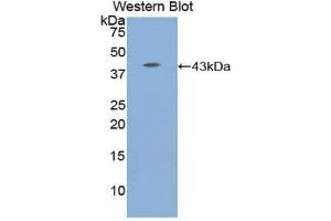 Western Blotting (WB) image for anti-Complement Component 8, beta Polypeptide (C8B) (AA 162-504) antibody (ABIN3206899)