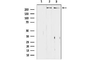 anti-Asp (Abnormal Spindle) Homolog, Microcephaly Associated (ASPM) (Internal Region) antibody