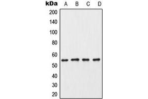 Western blot analysis of CK1 gamma 3 expression in HeLa (A), mouse testis (B), rat testis (C), PC12 (D) whole cell lysates. (CSNK1G3 Antikörper  (C-Term))