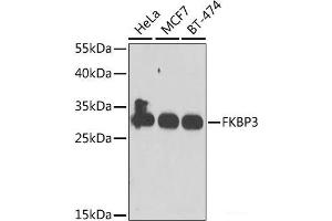 Western blot analysis of extracts of various cell lines using FKBP3 Polyclonal Antibody at dilution of 1:1000. (FKBP3 Antikörper)