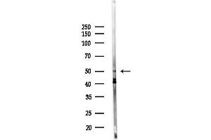 anti-STEAP Family Member 4 (STEAP4) (C-Term) antibody