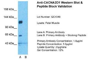 Host:  Rabbit  Target Name:  CACNA2D1  Sample Type:  Fetal Muscle  Lane A:  Primary Antibody  Lane B:  Primary Antibody + Blocking Peptide  Primary Antibody Concentration:  1ug/ml  Peptide Concentration:  5ug/ml  Lysate Quantity:  25ug/lane/Lane  Gel Concentration:  0. (CACNA2D1 Antikörper  (Middle Region))