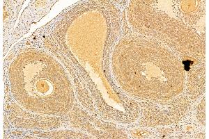 ABIN6265173 and ABIN6269300 at 1/100 staining Rat ovary tissue by IHC-P.