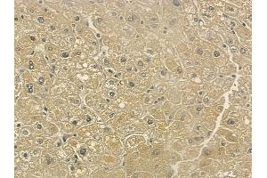 ABIN6261040 and ABIN6273217 at 1/100 staining human normal liver tissue by IHC-P.