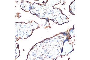 Immunohistochemistry of paraffin-embedded human placenta using CYPOR Rabbit mAb (ABIN7269151) at dilution of 1:100 (40x lens). (POR Antikörper)