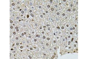 Immunohistochemistry (Paraffin-embedded Sections) (IHC (p)) image for anti-Polynucleotide Kinase 3'-Phosphatase (PNKP) antibody (ABIN7262583)