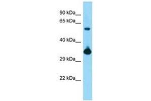 Image no. 1 for anti-BMI1 Polycomb Ring Finger Oncogene (BMI1) (AA 181-230) antibody (ABIN6748382) (BMI1 Antikörper  (AA 181-230))