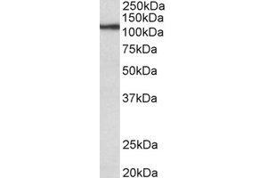 Western Blotting (WB) image for anti-Thyroid Peroxidase (TPO) (Internal Region) antibody (ABIN2464949) (Thyroperoxidase Antikörper  (Internal Region))