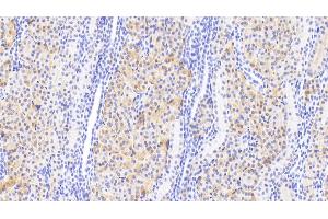 Detection of DDC in Human Kidney Tissue using Polyclonal Antibody to Dopa Decarboxylase (DDC) (DDC Antikörper  (AA 200-420))