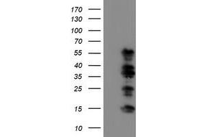 Western Blotting (WB) image for anti-WW Domain Containing Transcription Regulator 1 (WWTR1) antibody (ABIN1501763) (WWTR1 Antikörper)