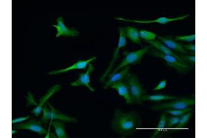 Immunofluorescence of purified MaxPab antibody to PSME1 on HeLa cell.