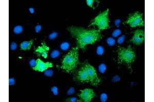 Anti-KATNB1 mouse monoclonal antibody (ABIN2455186) immunofluorescent staining of COS7 cells transiently transfected by pCMV6-ENTRY KATNB1 (RC201852). (KATNB1 Antikörper)