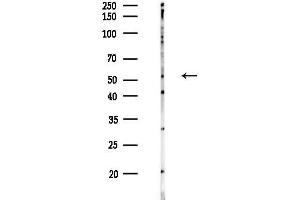 anti-Bone Morphogenetic Protein 3 (BMP3) (Internal Region) antibody
