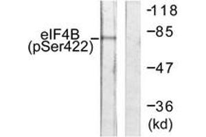 Western blot analysis of extracts from NIH-3T3 cells, using eIF4B (Phospho-Ser422) Antibody. (EIF4B Antikörper  (pSer422))