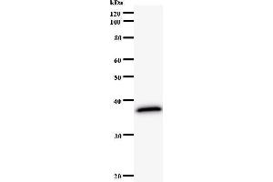 Western Blotting (WB) image for anti-Nei Endonuclease VIII-Like 3 (NEIL3) antibody (ABIN931131) (NEIL3 Antikörper)