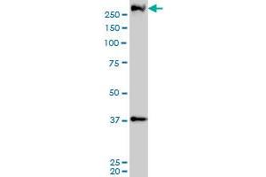PARC monoclonal antibody (M01), clone 3F7 Western Blot analysis of PARC expression in A-431 (CUL9 Antikörper  (AA 918-1025))