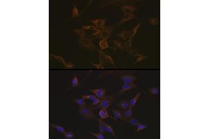 Immunofluorescence analysis of NIH-3T3 cells using EB3/M Rabbit mAb (ABIN7268535) at dilution of 1:100 (40x lens). (MAPRE3 Antikörper)
