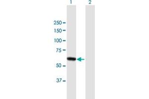 Western Blot analysis of DPYSL4 expression in transfected 293T cell line by DPYSL4 MaxPab polyclonal antibody. (DPYSL4 Antikörper  (AA 1-572))