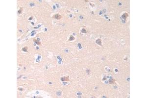 IHC-P analysis of brain tissue, with DAB staining. (Cathepsin W Antikörper  (AA 22-376))