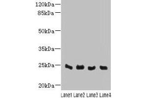 Western blot All lanes: C4orf33 antibody at 4 μg/mL Lane 1: Mouse kidney tissue Lane 2: Mouse liver tissue Lane 3: Mouse lung tissue Lane 4: Mouse heart tissue Secondary Goat polyclonal to rabbit IgG at 1/10000 dilution Predicted band size: 24 kDa Observed band size: 24 kDa (C4orf33 Antikörper  (AA 1-199))